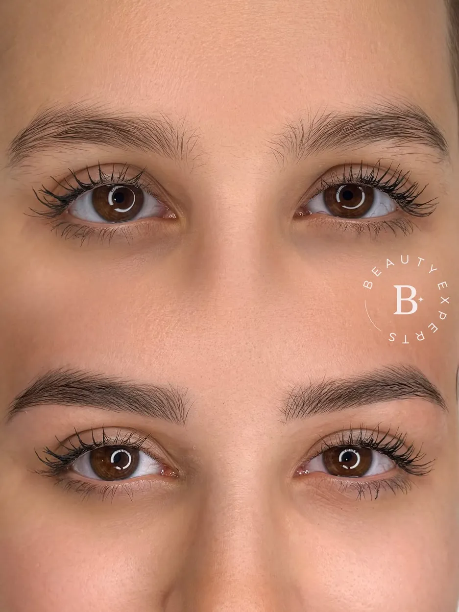 Before and after hair-stroke microblading in Málaga
