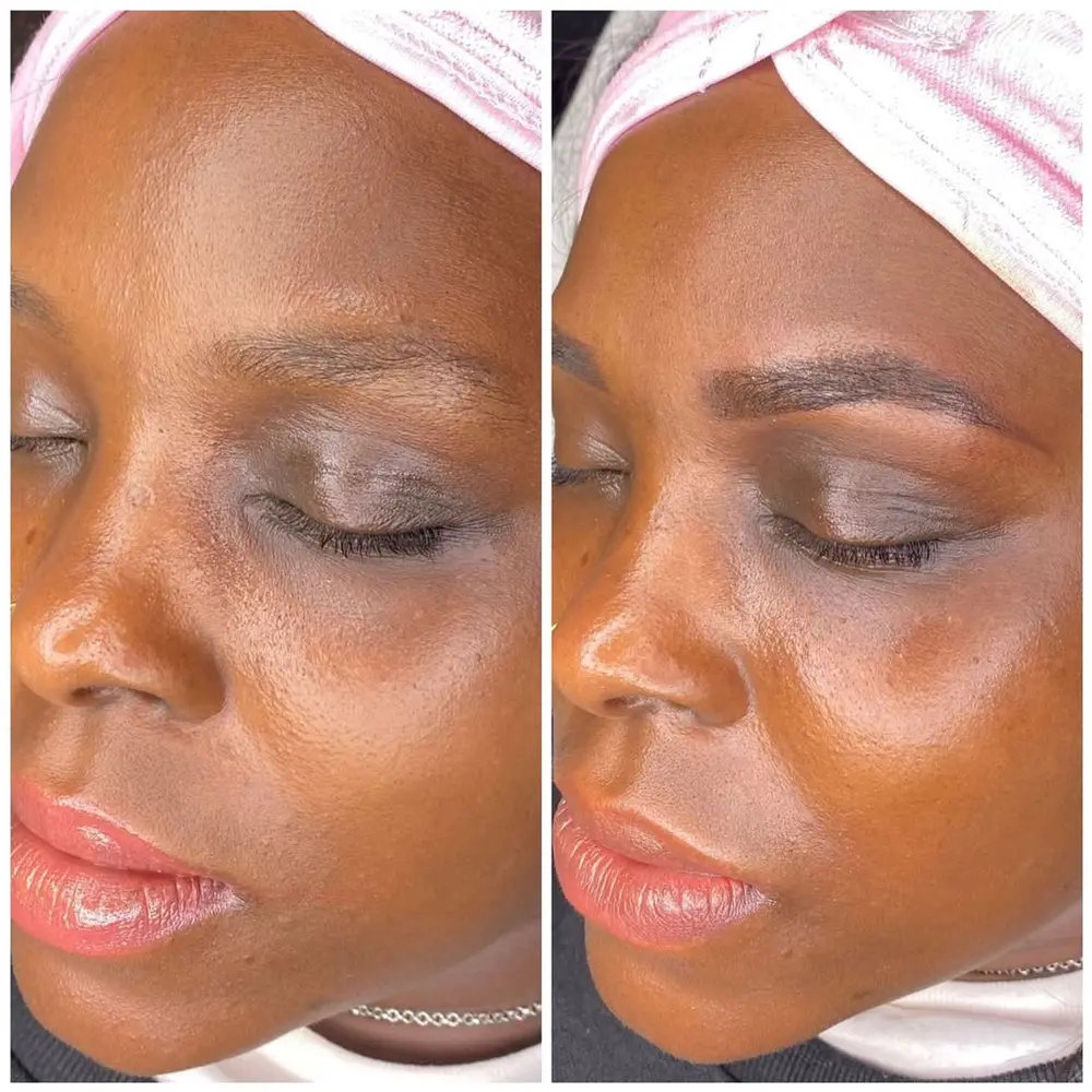 Antes y después de micropigmentación de cejas efecto shading en Málaga